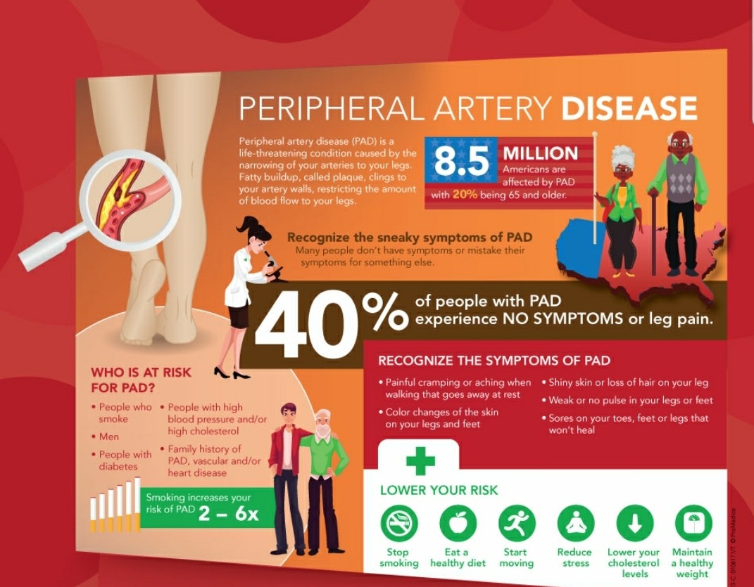 PAD- peripheral artery Disease- Basic Overview. 2022-02-06 Dr Paramjit ...